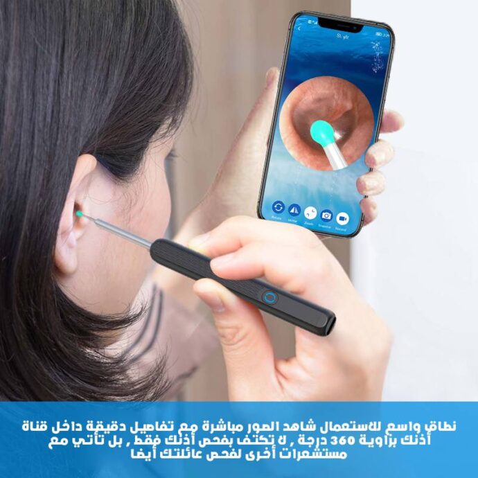 ⁦منظف الأذن الذكي بكاميرا - Baton d'Oreille⁩ - الصورة ⁦5⁩
