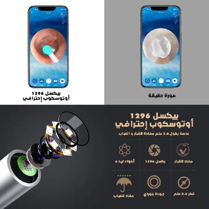 ⁦منظف الأذن الذكي بكاميرا - Baton d'Oreille⁩ - الصورة ⁦4⁩